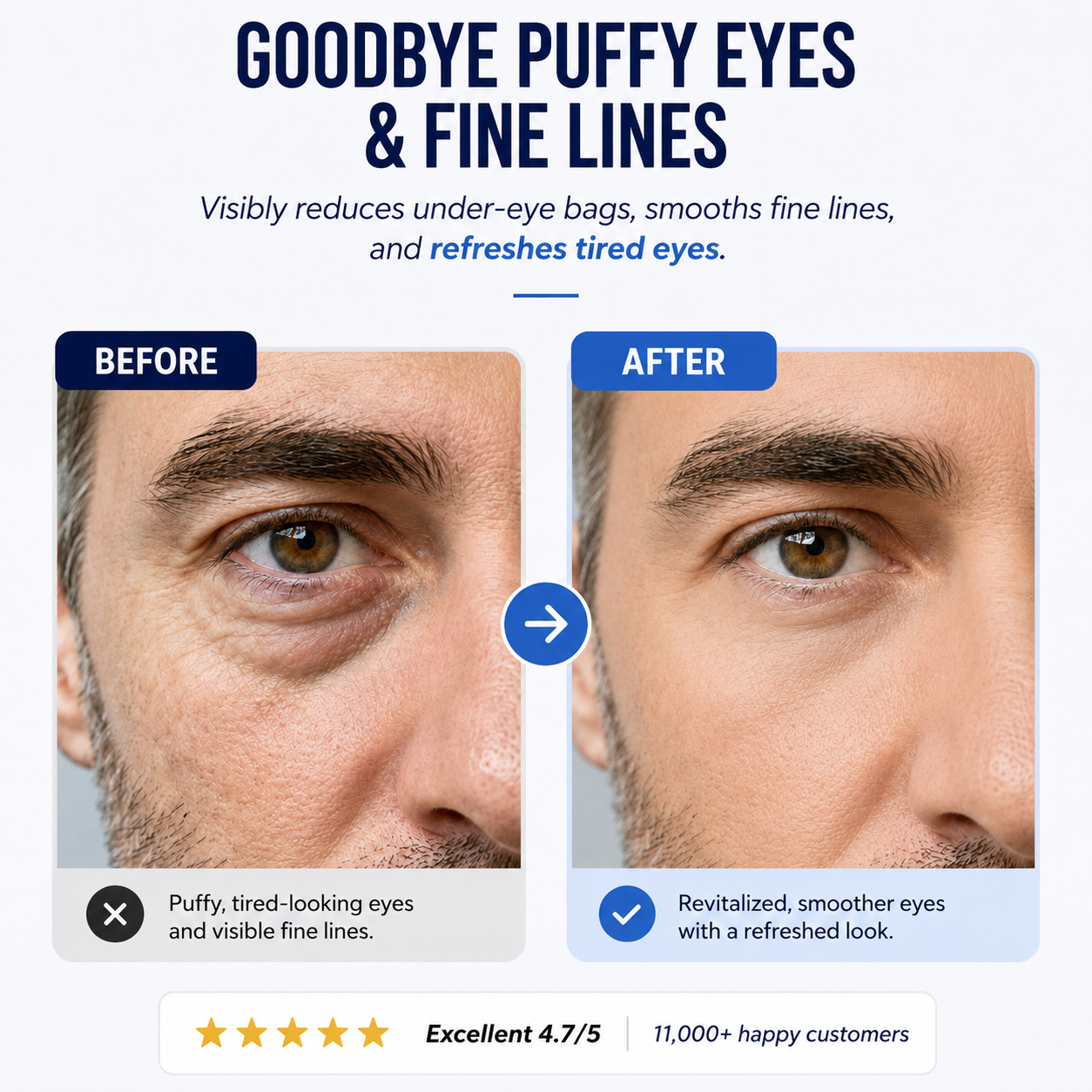 Refresh™ Eye Patches for Men